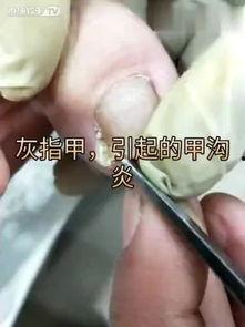 修脚刀磨刀视频,视频教学带你轻松掌握